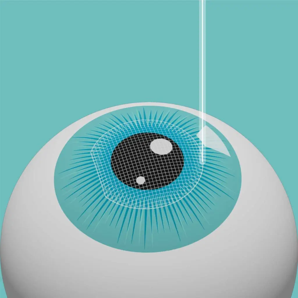 Laser-eye-surgery-procedure-step-2