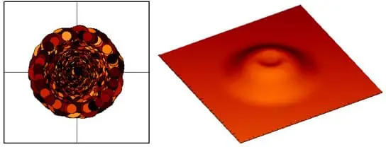 Centre for Sight MyopicSupracorTreatment