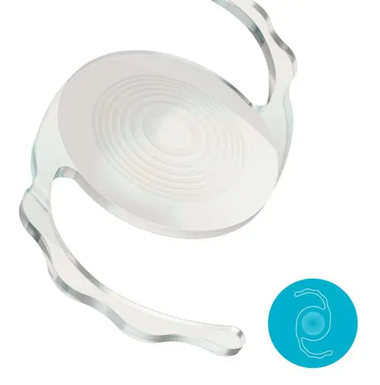 Trifocal-PiggyBack-Lens-IOL-Sulcoflex-