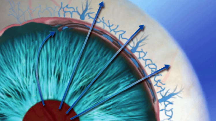 hydrus_mechanism_image_4