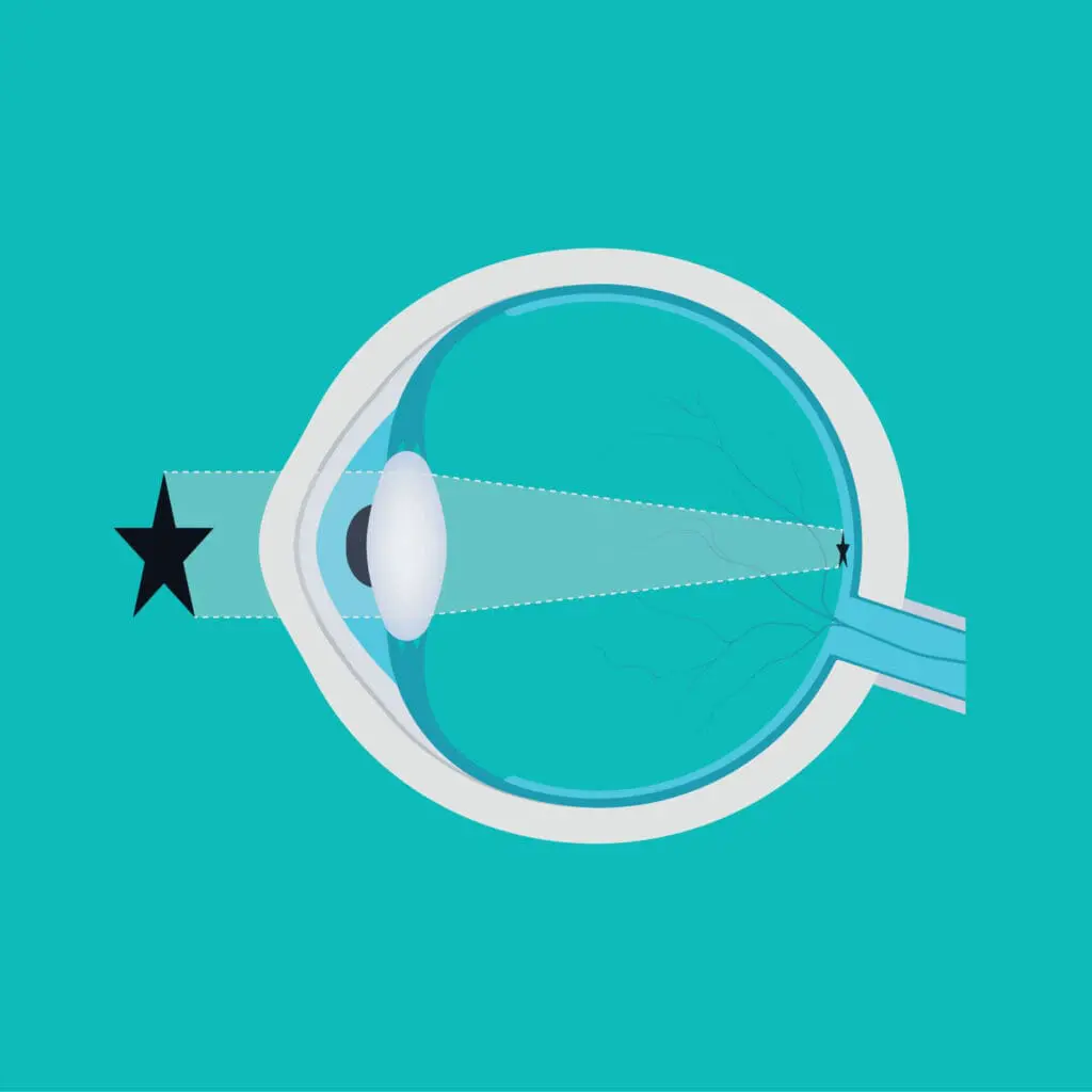 diagram of eye showing how the eye works
