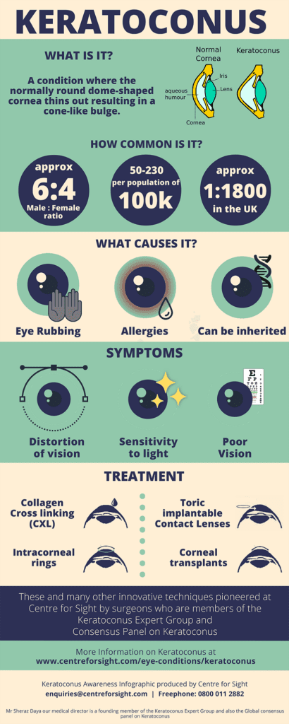 Centre for Sight keratoconus-infographic