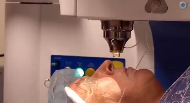 Centreforsight- Optom Day Patient-victus femtosecond laser