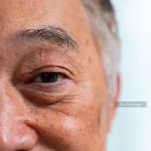 Older man with grey hair and eyebrows Centre for Sight stock image for Cataract Surgery Through the Ages Blog Post Close Up Image of Man's Eye