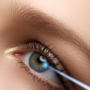 Ladies close up green eye with blonde eyebrow laser eye surgery