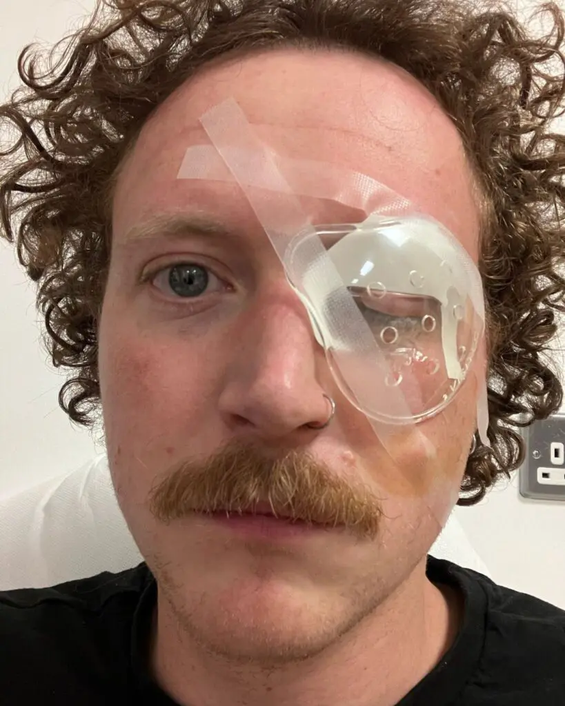 Patrick Caro Centre for Sight Patient Treatment After Eye Injury Cap Covering Operated Eye Young Man