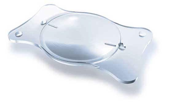 TrifocLenses for Cataract and Lens Replacement Surgery