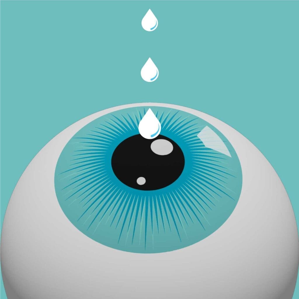 Laser-eye-surgery-procedure-step-1