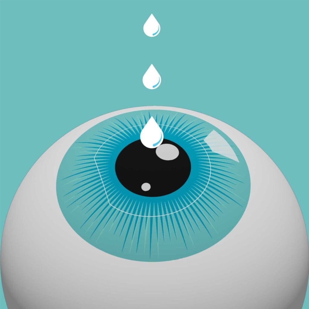 Laser-eye-surgery-procedure-step-fina