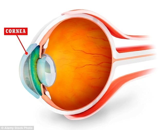 Centre for Sight Synthetic Corneal Transplant Offers Hope for Sight Loss