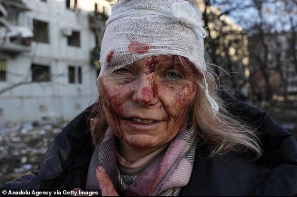 Centre for Sight Saves Ukrainian Teacher's Sight Daily Mail