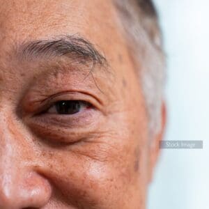 Older man with grey hair and eyebrows Centre for Sight stock image for Cataract Surgery Through the Ages Blog Post Close Up Image of Man's Eye