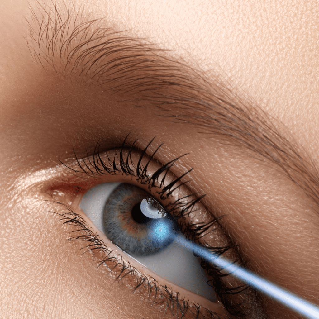 Ladies close up green eye with blonde eyebrow laser eye surgery