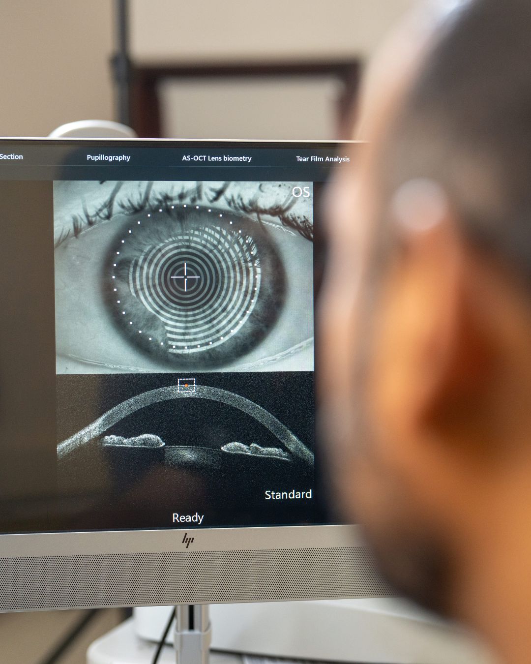 Cataract Surgery 5 A person sits in front of a monitor displaying detailed eye scans, including a close-up of an eye with measurement rings and a cross-section beneath it, likely during a premium eye care exam or medical assessment.